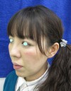 たった数分で　確実に　でも　さりげなく　貴女の美しさを　引き出します：DR　近藤　こだわりのラディエッセ注入　ゴルゴライン・アゴ