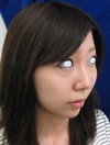 DR近藤　こだわりのプチ整形　（ラディエッセ注入　あご　鼻）