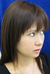 DR.　近藤　こだわりのプチ整形　ラディエッセ注入　ゴルゴライン(チーク）・アゴ