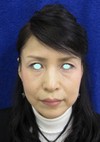 たった数分でさりげなく　でも　確実にお綺麗になれます！　自分の血液から作るGEL　＆　ラディエッセ注入