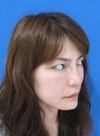 自分の血液から作るジェルで　活き活きチーク！　PPP-GEL注入療法