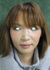 私の目指す美容医療　最小侵襲美容外科　MIAS：Dr　近藤オリジナル　切らないお顔の引き上げ術　チタンペックリフト