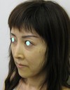 私の目指す美容医療　最小侵襲美容外科　MIAS：Dr.近藤オリジナル　切らないお顔の引き上げ術　チタンペックリフト