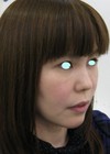 私の目指す美容医療　MIAS：　DR近藤オリジナル切らないお顔の引き上げ術　チタンペックリフト　＋　自分の血液から作るゲル（PPP-GEL）のチークへの注入　