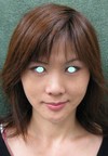 私の目指す美容医療　最小侵襲美容外科　MIAS：Dr.近藤オリジナル　切らないお顔の引き上げ術　チタンペックリフト