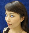 手術でなくても　ほんの数分で　こんなに綺麗になれます！　DR近藤　こだわりの　ラディエッセ注入　（ゴルゴライン　アゴ）