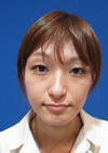 美創り：持続性をUP!　ワンランク上のPPP-GEL（ジェル）  SOグレイスオリジナル　コラーゲン新生PPP-GEL注入療法　チーク注入